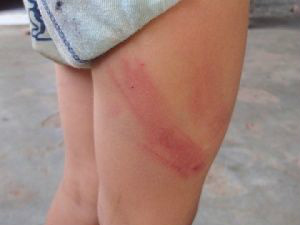 Pai é detido após agredir filho de três anos com chicote