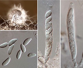 Nova praga da soja no Brasil Pela primeira vez Colletotrichum cliviae é relatado causando antracnose em soja no Brasil / Foto: Divulgação