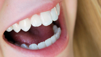 Programa de saúde bucal vai oferecer aparelho ortodôntico e implante dentário