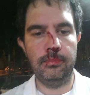 O médico Eduardo Munhoz também postou fotos em sua rede social sobre a briga; nariz dele aparece machucado 