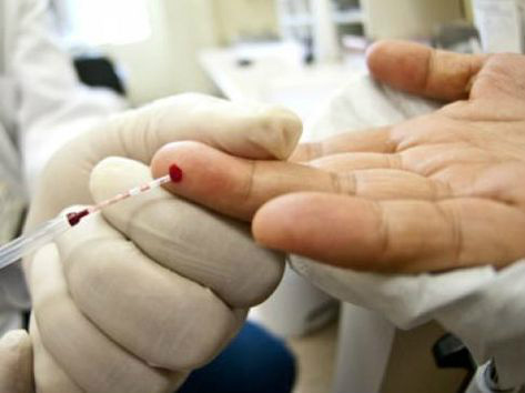 15,8 milhões de pessoas com HIV recebem tratamento