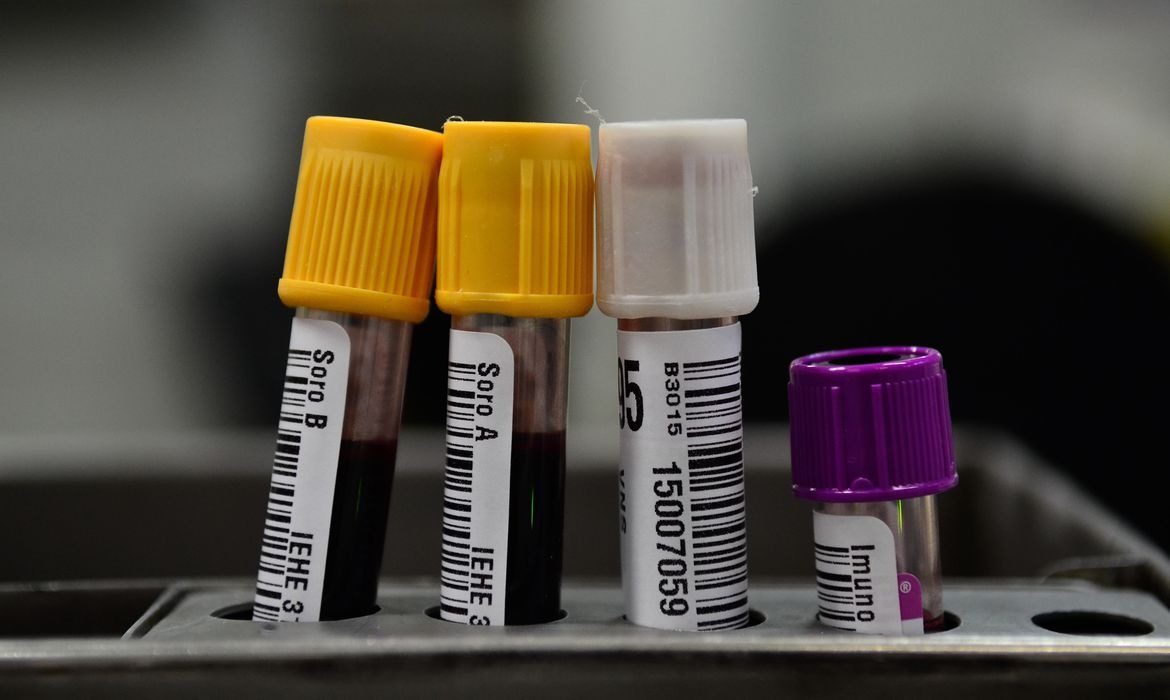 Hemorio inicia testes com plasma sanguíneo no tratamento de covid-19 Fernando Frazão