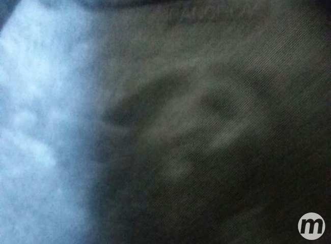 Imagem de Jesus em ultrassom de idoso surpreende cidade de MS Foto: Divulgação
