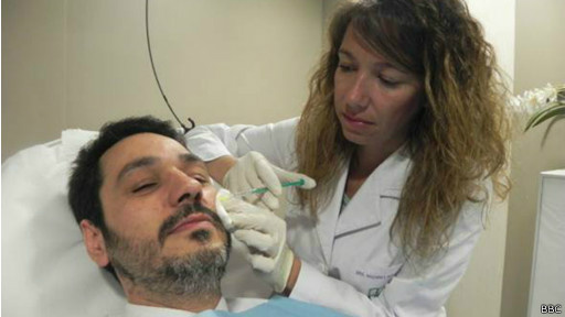 Uso de botox ganhou popularidade entre homens espanhóis desempregados 