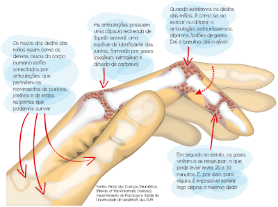 Você estala os dedos? Não deveria fazer isso…