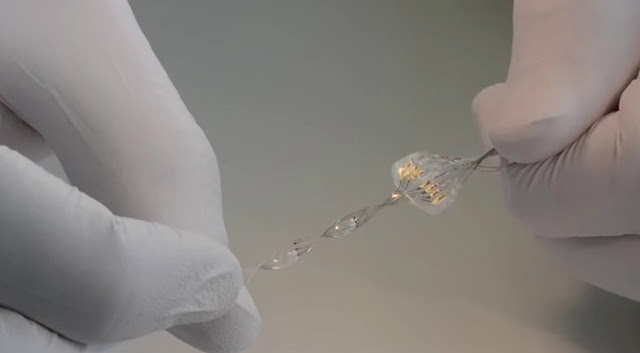 4 implantes biônicos incríveis que são REALIDADE 4 implantes biônicos incríveis que são REALIDADE