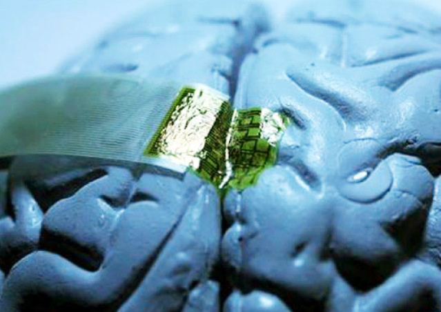 4 implantes biônicos incríveis que são REALIDADE 4 implantes biônicos incríveis que são REALIDADE