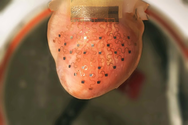 4 implantes biônicos incríveis que são REALIDADE 4 implantes biônicos incríveis que são REALIDADE