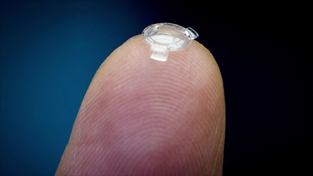 4 implantes biônicos incríveis que são REALIDADE 4 implantes biônicos incríveis que são REALIDADE