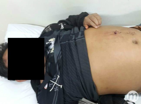 Fotos de feridos confirmam tiros em confronto entre índios e fazendeiros Índios vítimas do ataque foram feridos por disparos de arma de fogo / Foto: Midiamax