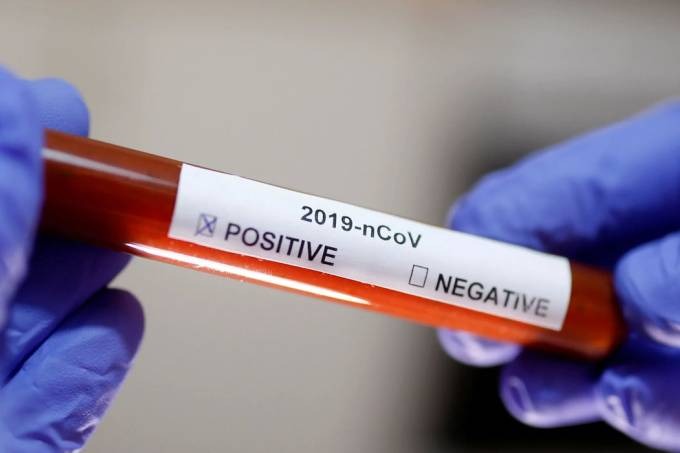 Sobe para 68 o número de infectados por coronavírus no Brasil Foto:Agência Brasil