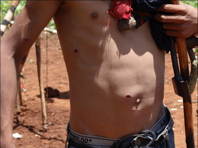 Após ataque, Guaranis Kaiowás decidem permanecer em terra tradicional Indígena ferido por balas de borracha - Foto: MPF/MS