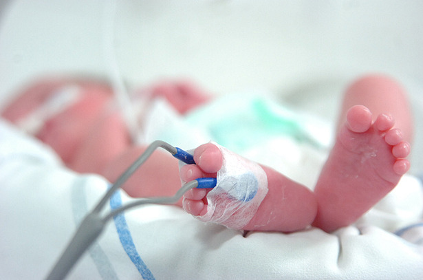 Ministério da Saúde lança estratégia para reduzir mortalidade neonatal