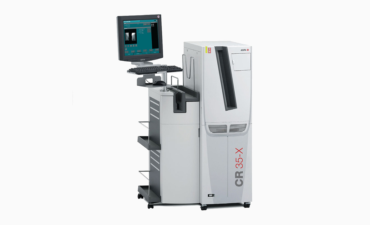 O aparelho CR Digitalizador pode ser utilizado para os mais variados fins diagnósticos / Foto: Ilustrativa