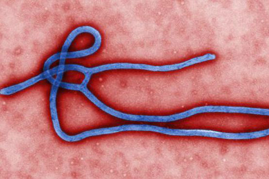 Espanha tem primeiro caso suspeito de ebola