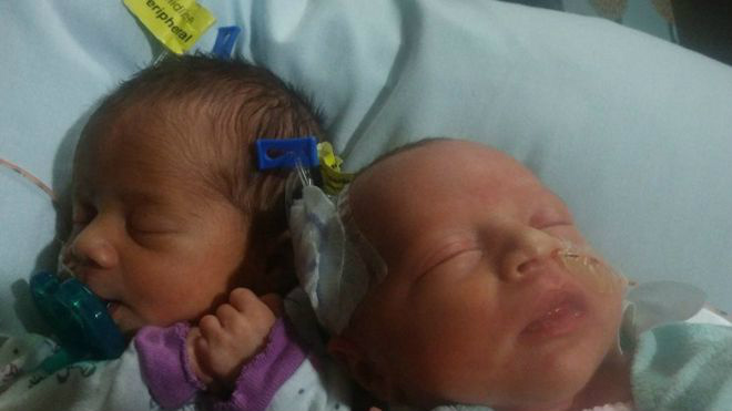 De 0 a 6 em 2 anos: Americana dá à luz 3 pares de gêmeos em 26 meses As irmãs gêmeas Darla (esq.) e Dalanie nasceram em 17 de junho